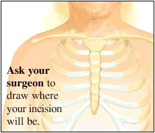 Image of chest