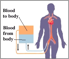 Image of heart-lung machine