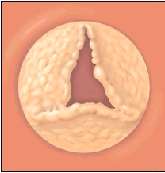 Cutaway view of heart