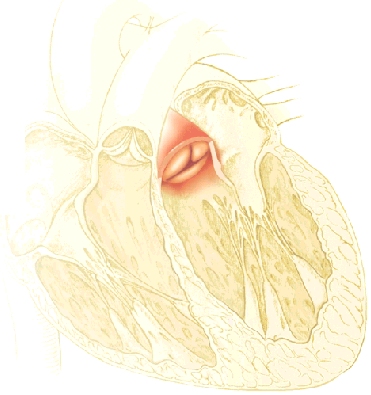 Cutaway view of heart